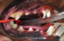 遺残乳歯（犬歯）1