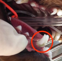 遺残乳歯（犬歯）2