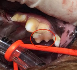 遺残乳歯（臼歯）